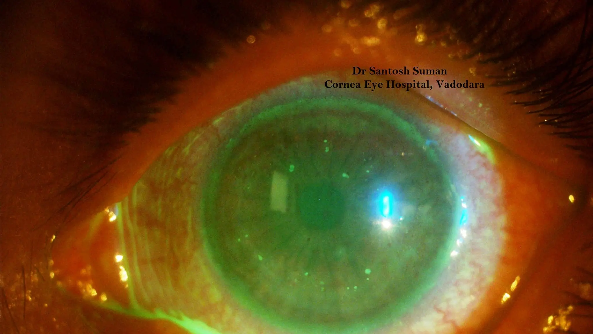 NT eye infection diagnosed in Wangaratta