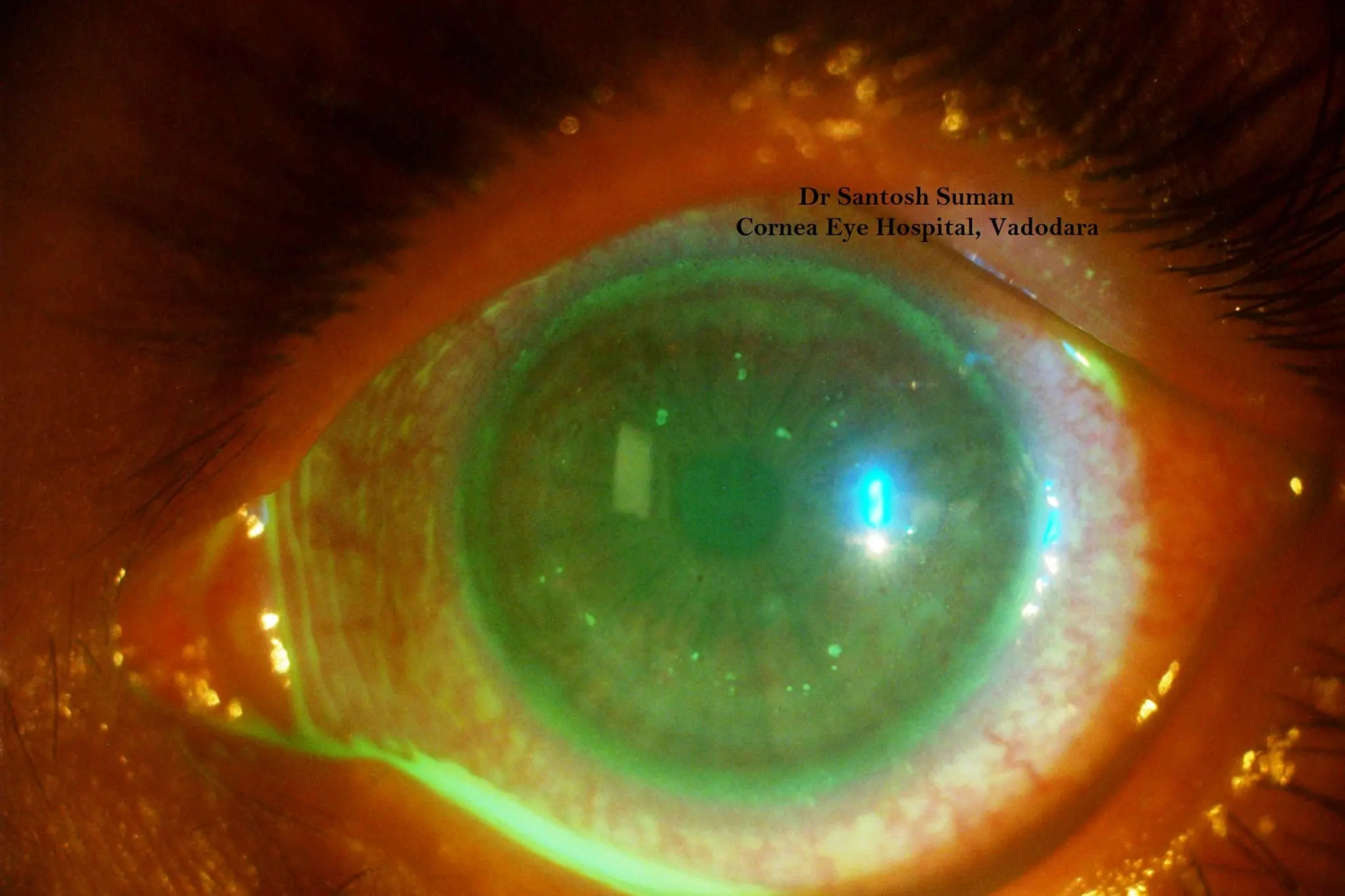 <p>Stock image of a case of Microsporidia.</p>\\n